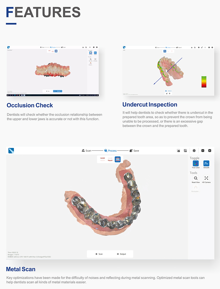 IOS33 Intraoral Scanner